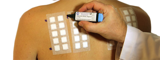 Med hjälp av våra patchtestplåster kan man testa flera olika allergener på samma gång, men ändå få e...