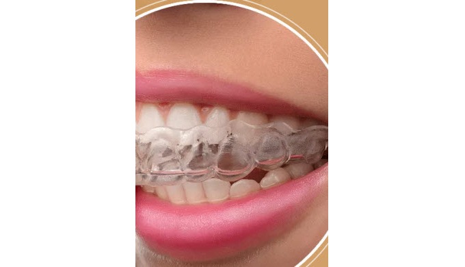 Periodontics, Dental Implants, Family Dentistry, Invisalign