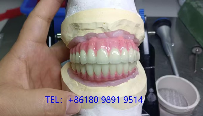 Full Service Dental Lab from China Myy is a full-service dental lab in China, offering end-to-end so...