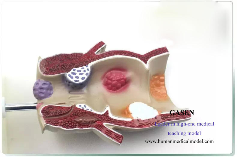 1. This model, as approximately 5 times as the size of the real product, shows various diseases of t...