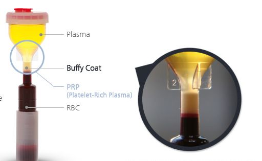 Platelet-Rich Plasma (PRP) is a cutting-edge biological and regenerative therapy for tissue regenera...