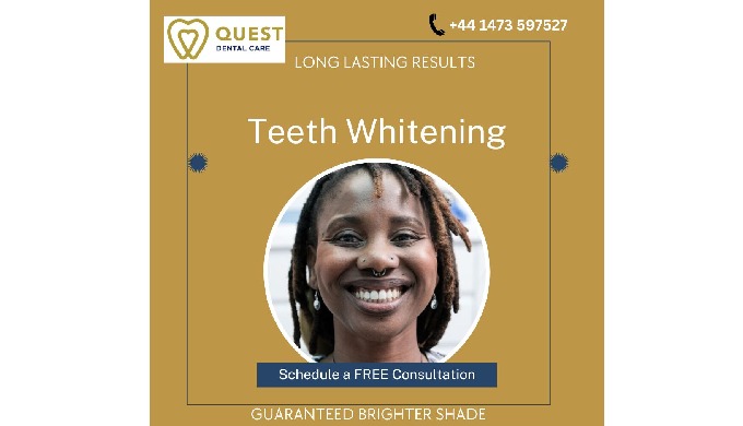 As we age, our teeth naturally discolour. This is a process that can be acc...