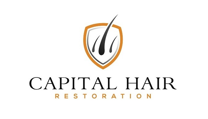 Hair transplant treatments for men and women. Professional hair loss implant restoration treatment t...