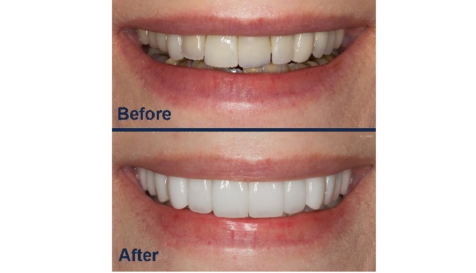 Dr Ashish Jain is the founder and the managing director of Smile Dental clinic, Indore established i...