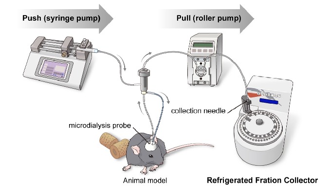 The push & pull microdialysis technique can be applied to clinical evaluation of pathological bi...