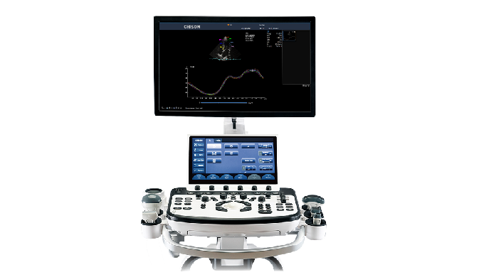 CHISON Xbit 90