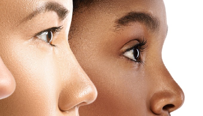 CHIC Laser Centre in downtown Montreal offers high-quality laser hair removal using safe and effecti...