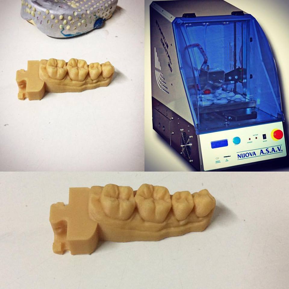La Stampante 3D FFF per il settore Dentale! Altessima precisiona di stampa e cura dei piccoli dettta...