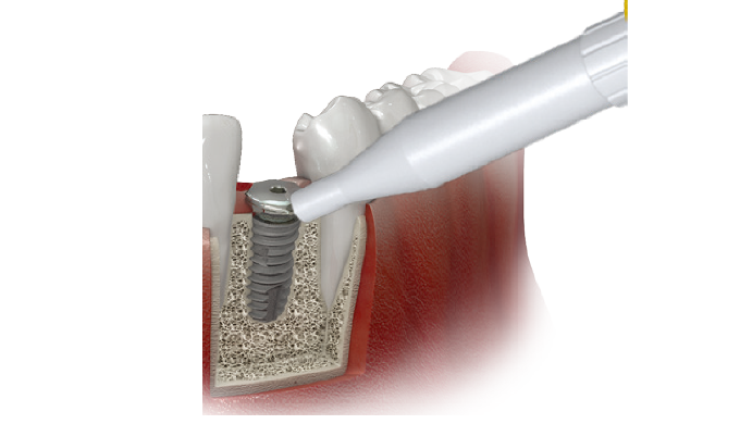 Any Check - Dental medical devices