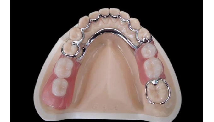 MYY Dental Limited The is a leading global dental prosthetics provider, distributor and consultant o...