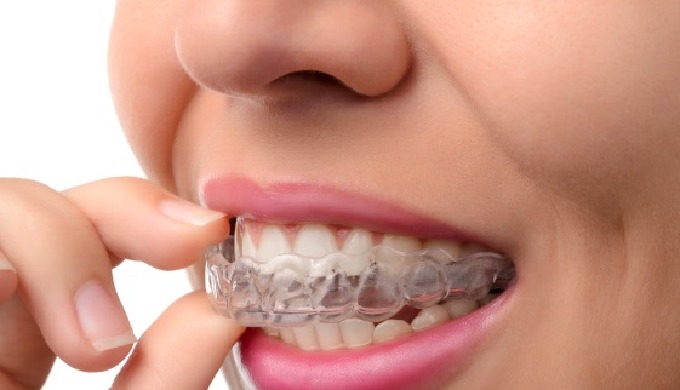 En Clínica Dental Almeida disponemos de las últimas innovaciones tecnológicas en aparatos y procedim...