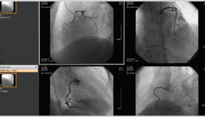 PACSPLUS Cardiac │ DICOM VIEWER Pacs Cardiology Viewer is a cardiologic advanced DICOM viewer includ...