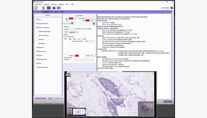 MedCockpit for Labs fits into the center of a histology lab’s workflow. It is a suite of secure, clo...