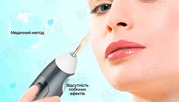Матеріали статті, частково взяти з сайту https://irosgadgets.com/ua/elektrokoagulyatory/, бульш дета...