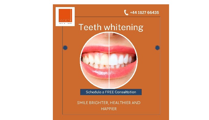 Teeth whitening is a way to cosmetically enhance the colour of your teeth, giving you a dazzling whi...
