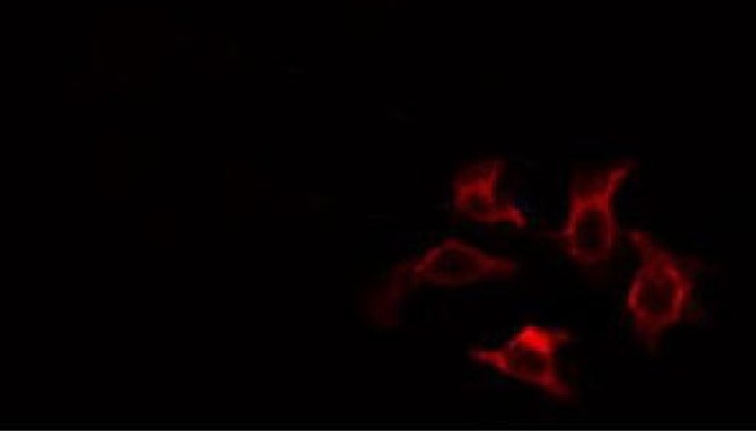The HSL (Hormone-Sensitive Lipase) Polyclonal Antibody from AAA Biotech (Catalog No. 31384) is a hig...