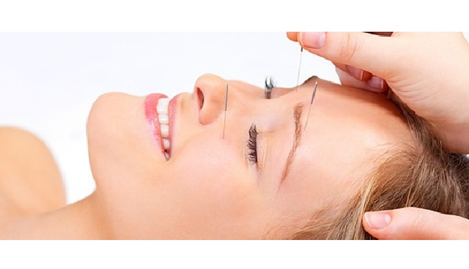 Here at Wellpoint, we are happy to help you using acupuncture or any additional other treatments tha...