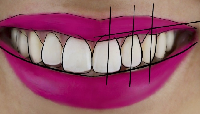 Nuestra Clínica Dental Roberto Checa está conformada por experimentados dentistas en Córdoba capital...