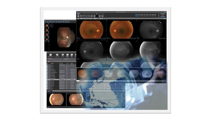 PACSPLUS Focus│DICOM VIEWER Ophthalmology PACS digitizes the ophthalmology practice. Now with the in...