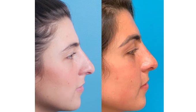 ENT Treatments, Allergy Treatments, Pediatric Allergy Treatments, Pediatric ENT Treatments, Snoring ...