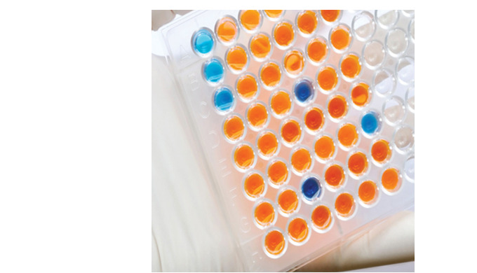 We provide elisa kits that can be used in various research of life sicences, Animal Elisa Kits, Plan...