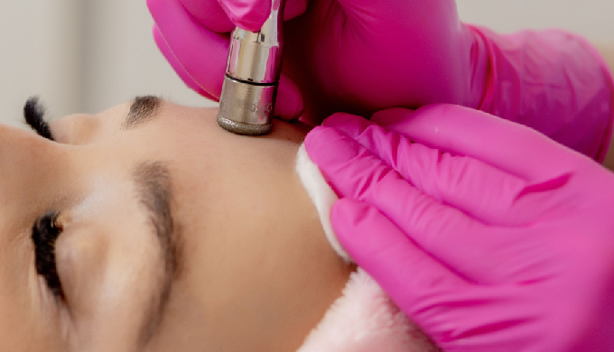 Diamond tipped Microdermabrasion is a deep exfoliating treatment to soften skin and remove blackhead...