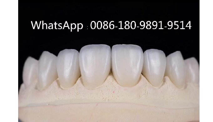 MYY Dental Lab is a professional manufacturer in China,have more than 20 years experience at customi...