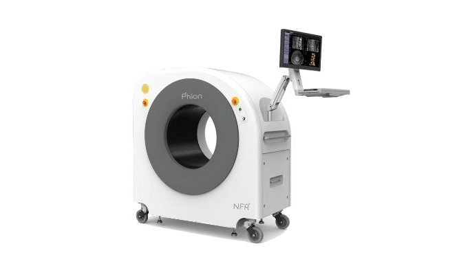 [Phion 2.0] A New Pioneer of Mobile Cone-Beam CT Mobile Cone-Beam CT for spine, Head & Neck, Ext...