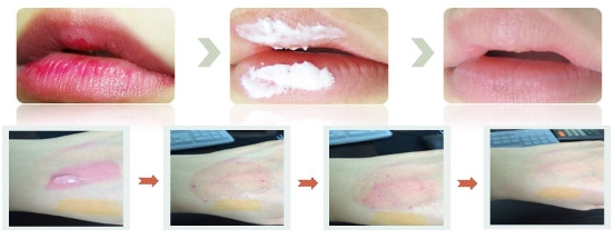 Mild Lip-only Cleanser 1. The lips are covered with thin and fragile skin, so you must use only lip-...